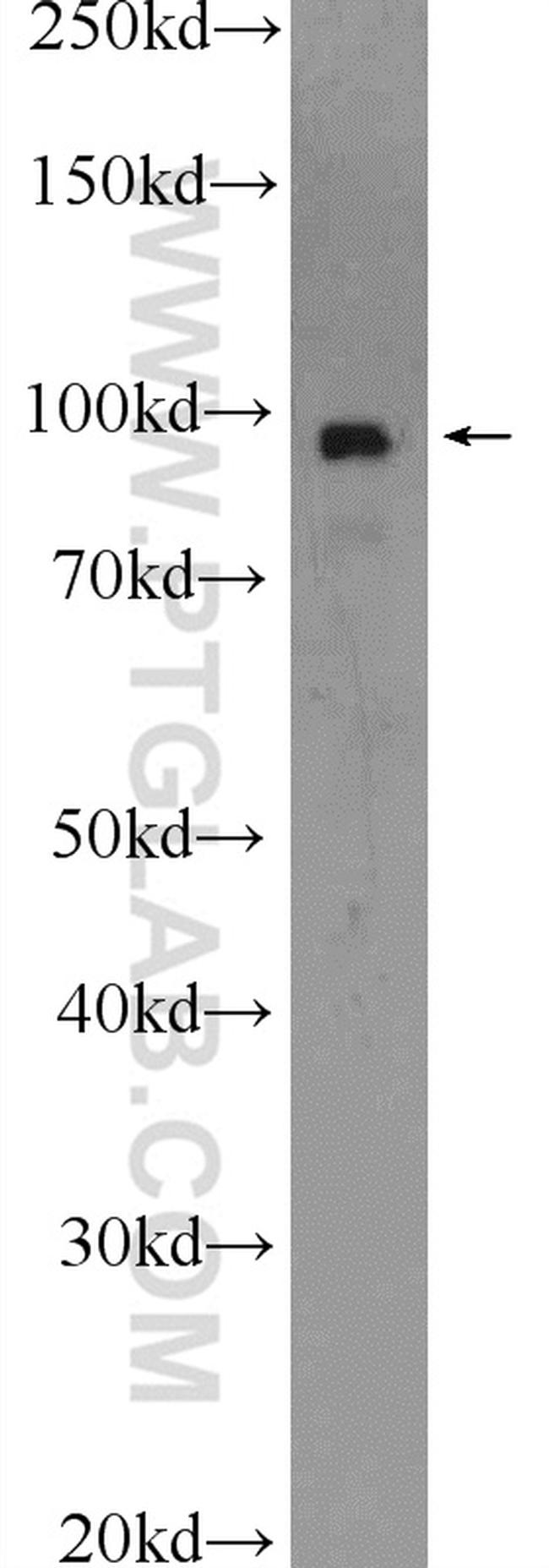 beta-Catenin Antibody in Western Blot (WB)