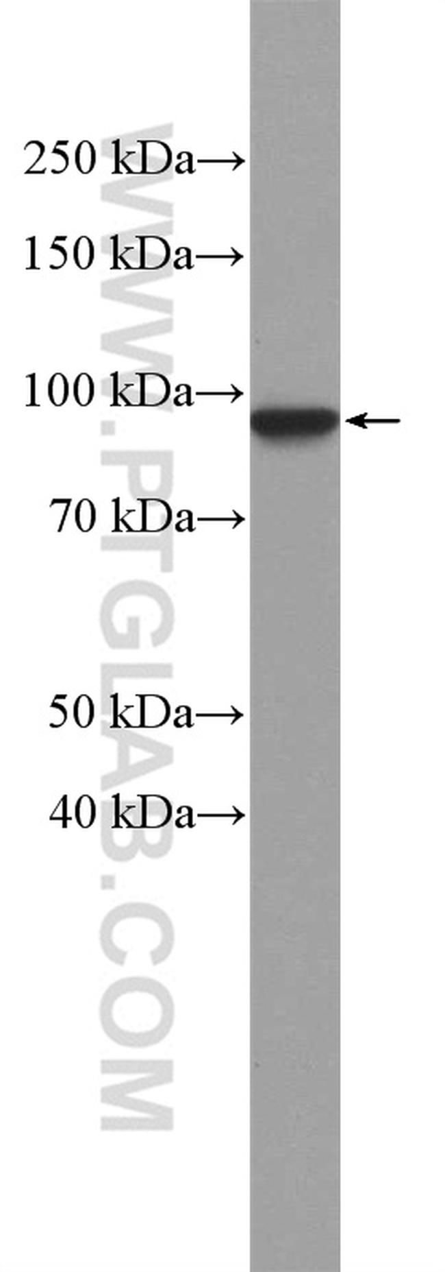 beta-Catenin Antibody in Western Blot (WB)