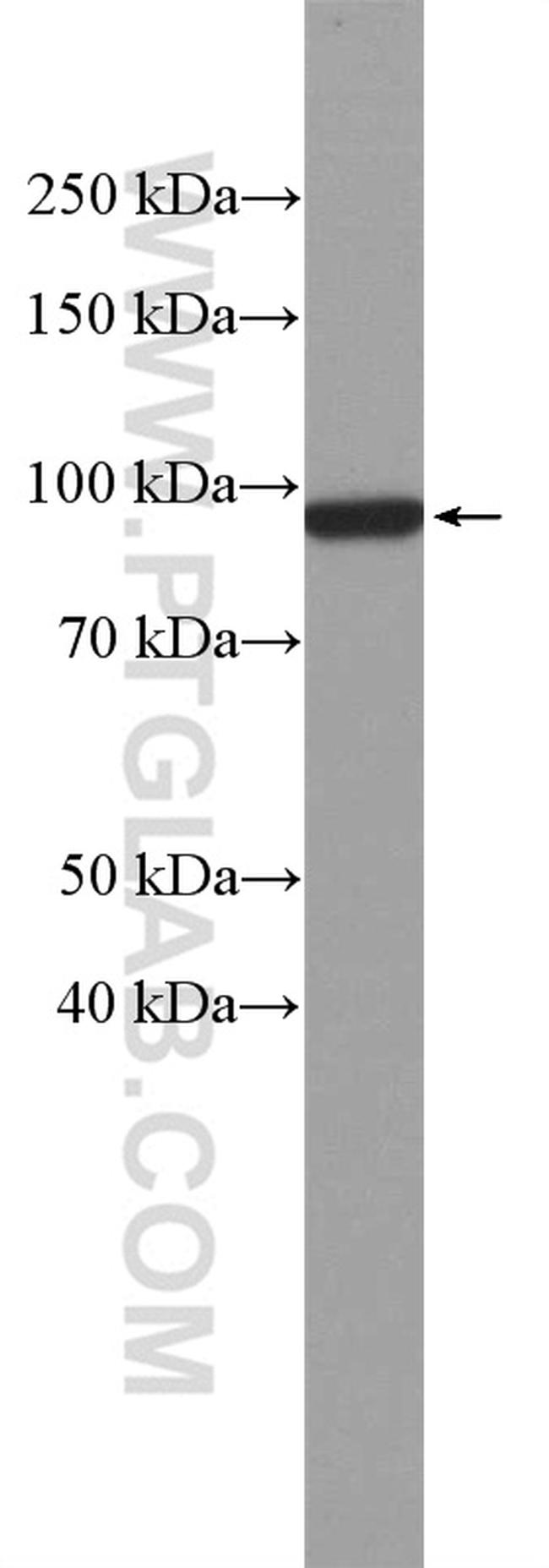 beta-Catenin Antibody in Western Blot (WB)