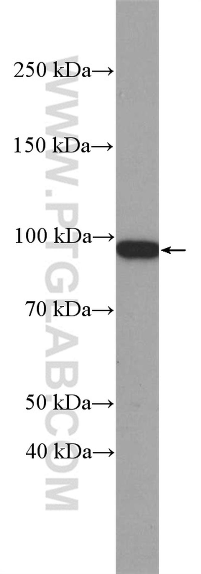 beta-Catenin Antibody in Western Blot (WB)