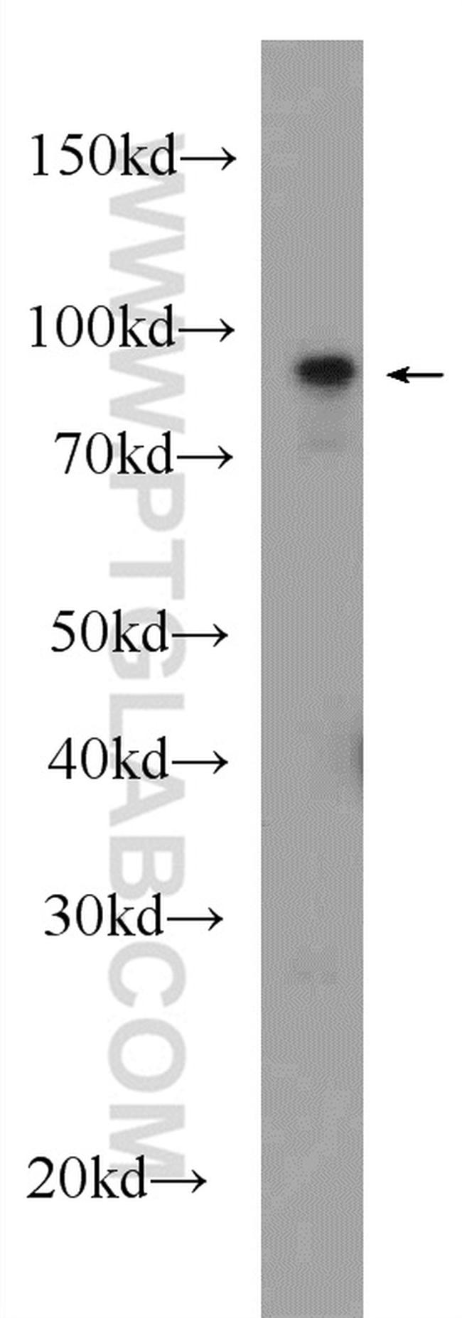 beta-Catenin Antibody in Western Blot (WB)