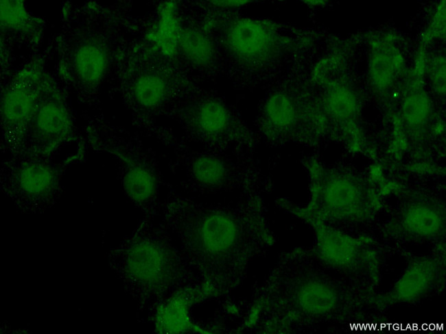 ACAP3 Antibody in Immunocytochemistry (ICC/IF)