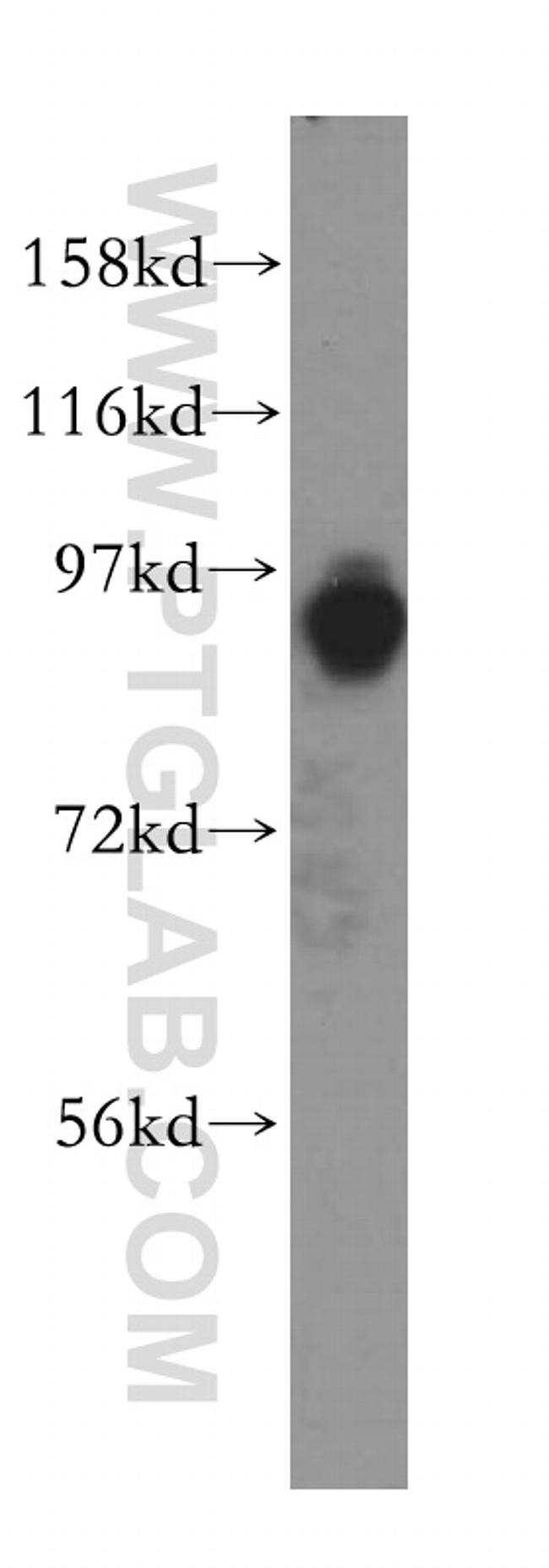 ACAP3 Antibody in Western Blot (WB)