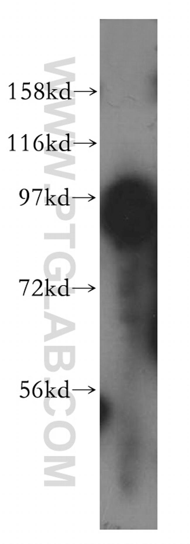 ACAP3 Antibody in Western Blot (WB)