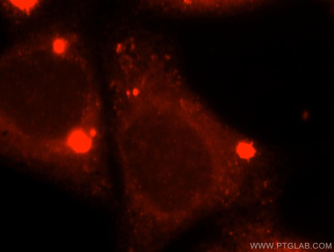 ACOX2 Antibody in Immunocytochemistry (ICC/IF)