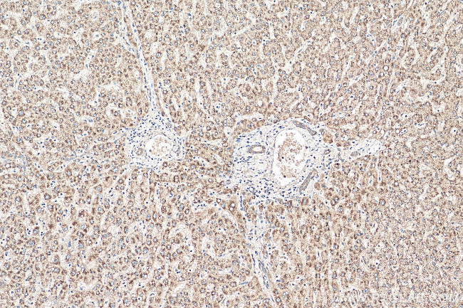 ACOX2 Antibody in Immunohistochemistry (Paraffin) (IHC (P))