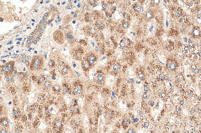 ACOX2 Antibody in Immunohistochemistry (Paraffin) (IHC (P))