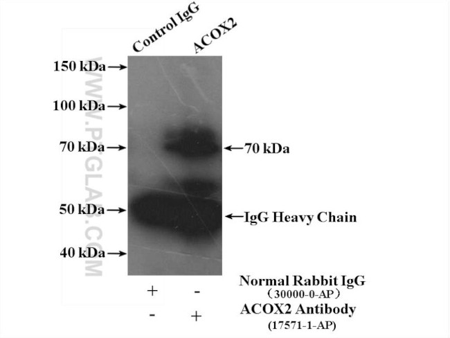 ACOX2 Antibody in Immunoprecipitation (IP)