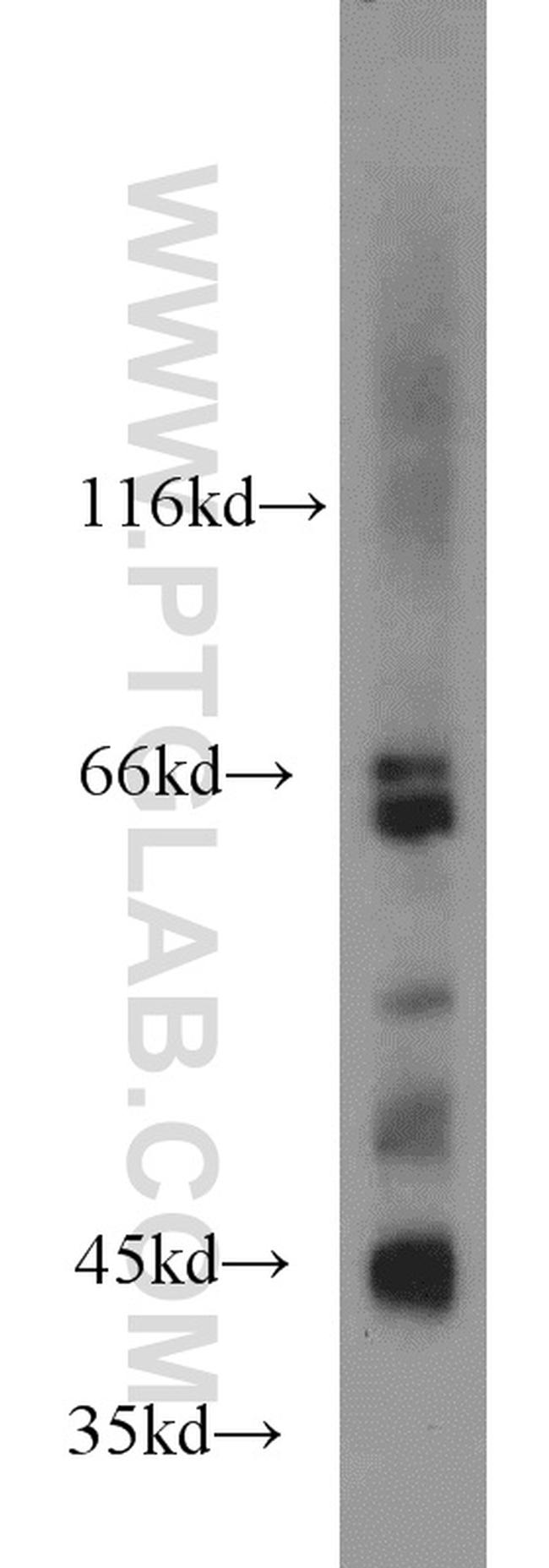 MAPK10 Antibody in Western Blot (WB)