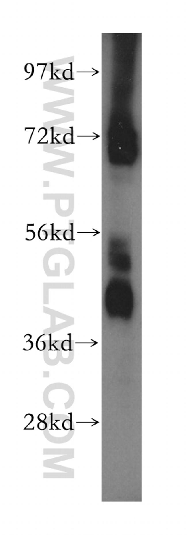 MAPK10 Antibody in Western Blot (WB)