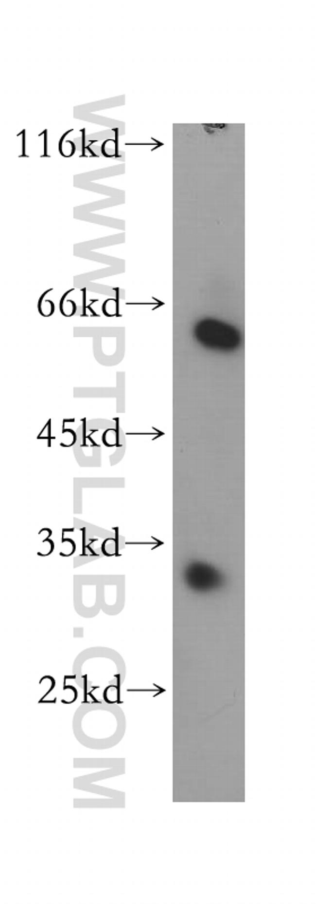 THNSL2 Antibody in Western Blot (WB)