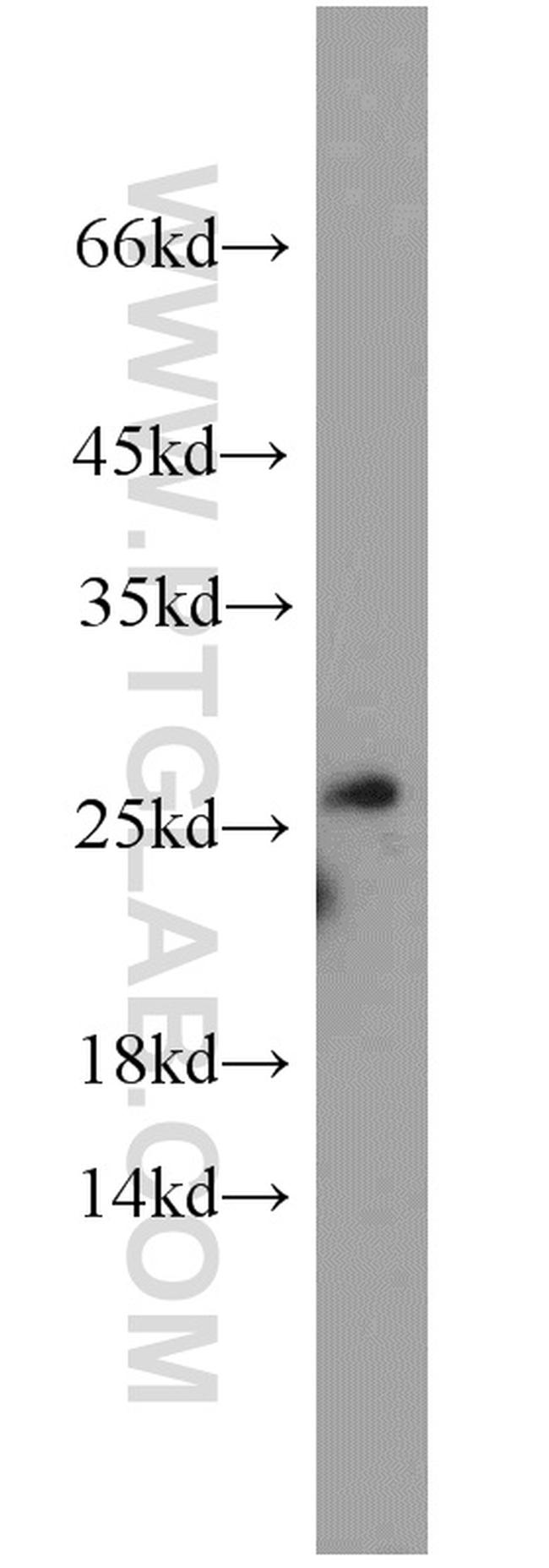 NRSN2 Antibody in Western Blot (WB)