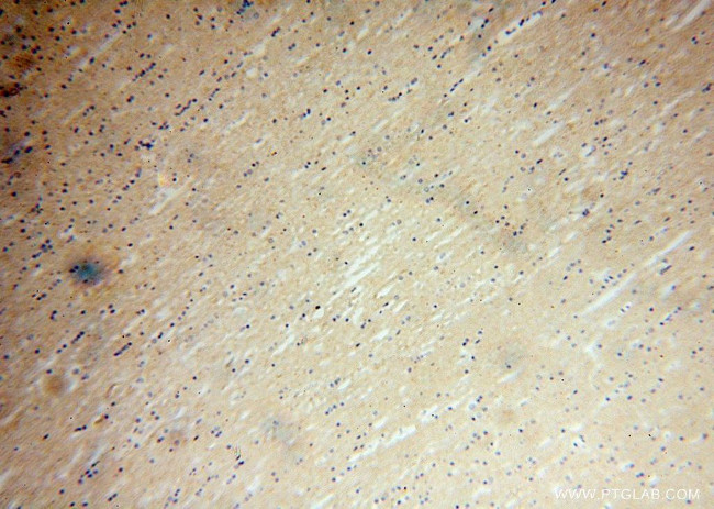 NRSN2 Antibody in Immunohistochemistry (Paraffin) (IHC (P))