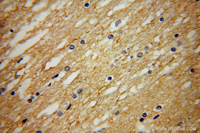 NRSN2 Antibody in Immunohistochemistry (Paraffin) (IHC (P))