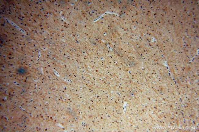 MDM1 Antibody in Immunohistochemistry (Paraffin) (IHC (P))