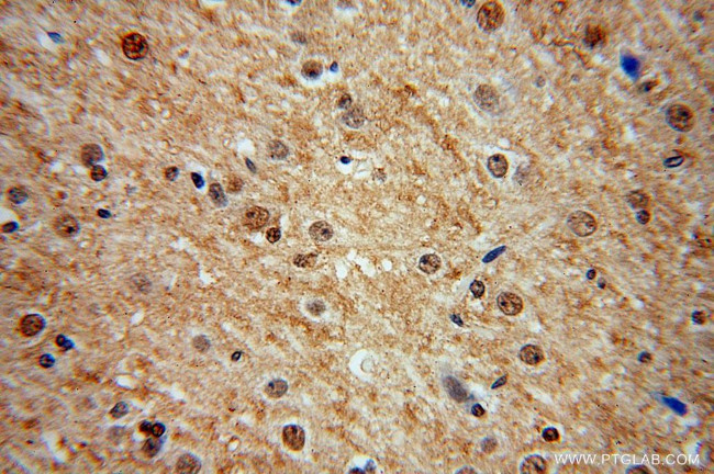 MDM1 Antibody in Immunohistochemistry (Paraffin) (IHC (P))