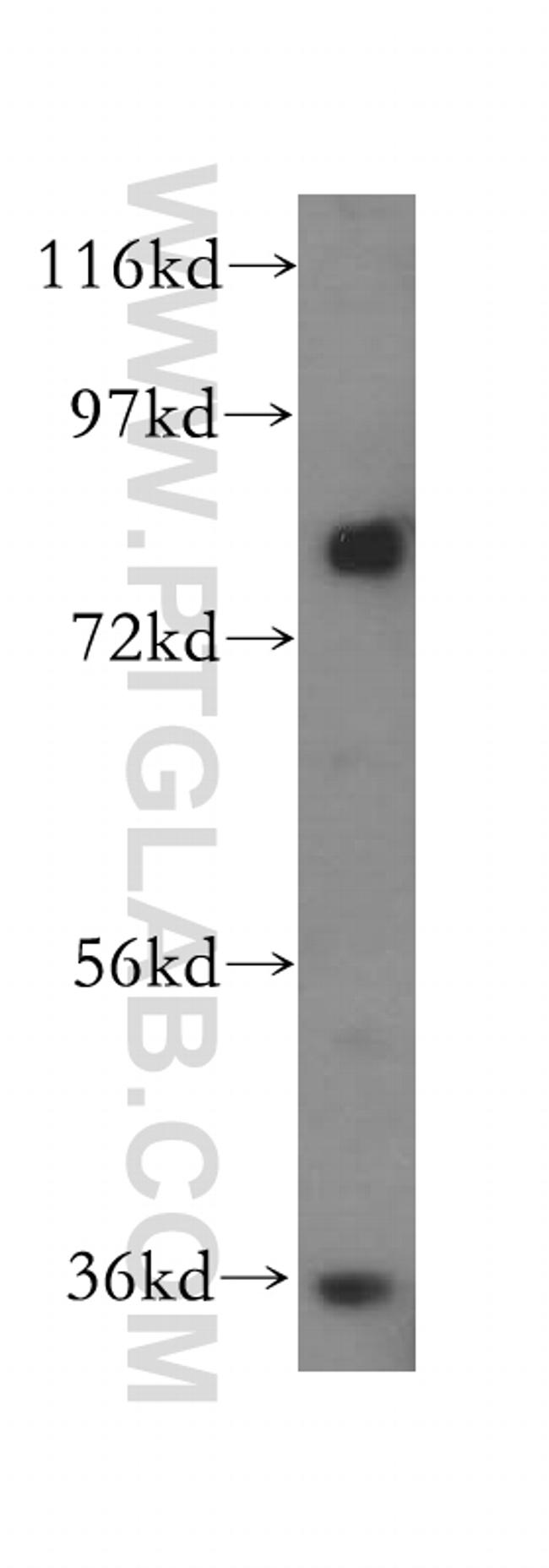 MDM1 Antibody in Western Blot (WB)