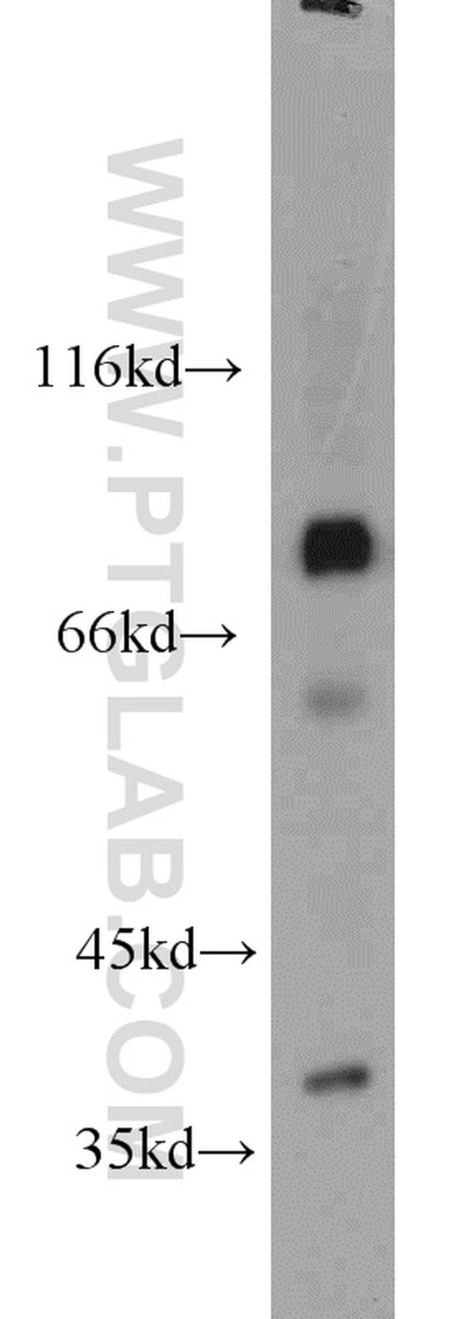 MDM1 Antibody in Western Blot (WB)