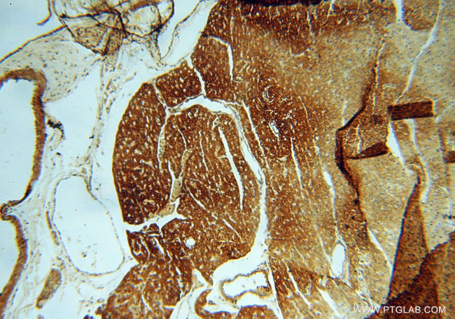 HRASLS5 Antibody in Immunohistochemistry (Paraffin) (IHC (P))