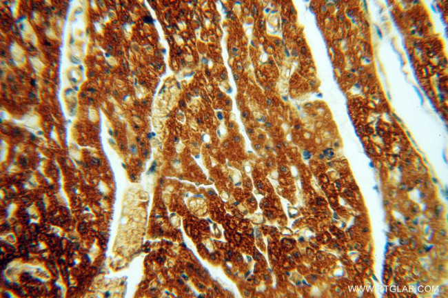 HRASLS5 Antibody in Immunohistochemistry (Paraffin) (IHC (P))