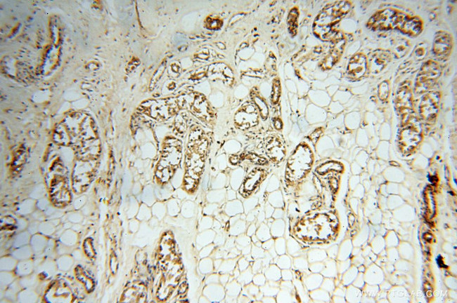 HRASLS5 Antibody in Immunohistochemistry (Paraffin) (IHC (P))