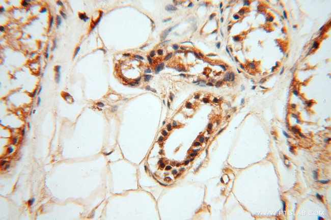 HRASLS5 Antibody in Immunohistochemistry (Paraffin) (IHC (P))