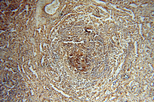 HRASLS5 Antibody in Immunohistochemistry (Paraffin) (IHC (P))