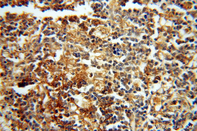 HRASLS5 Antibody in Immunohistochemistry (Paraffin) (IHC (P))