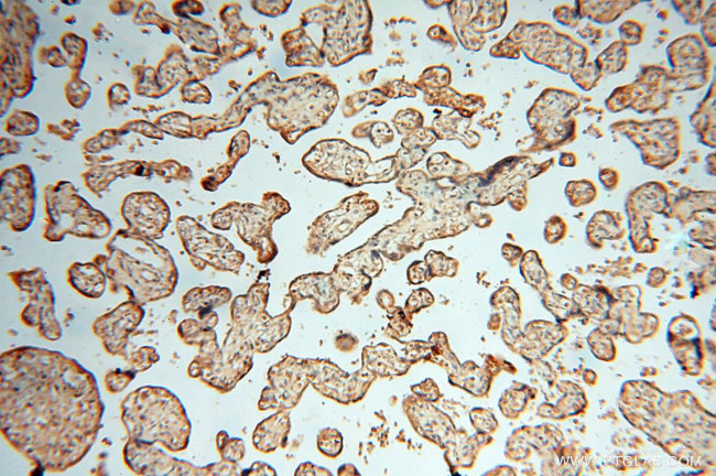 HRASLS5 Antibody in Immunohistochemistry (Paraffin) (IHC (P))