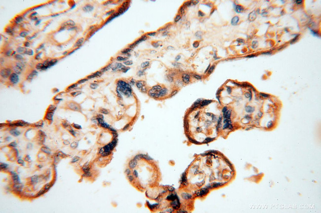 HRASLS5 Antibody in Immunohistochemistry (Paraffin) (IHC (P))