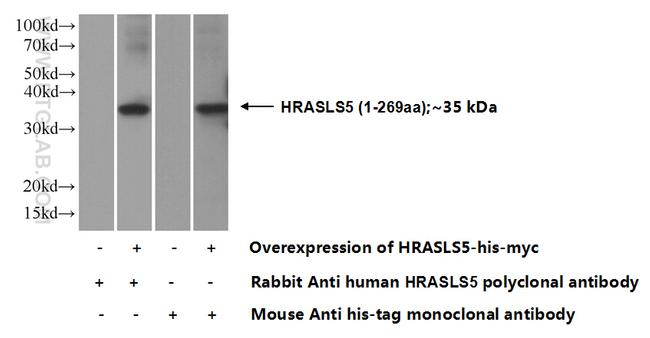 HRASLS5 Antibody in Western Blot (WB)