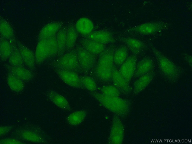 BXDC1 Antibody in Immunocytochemistry (ICC/IF)