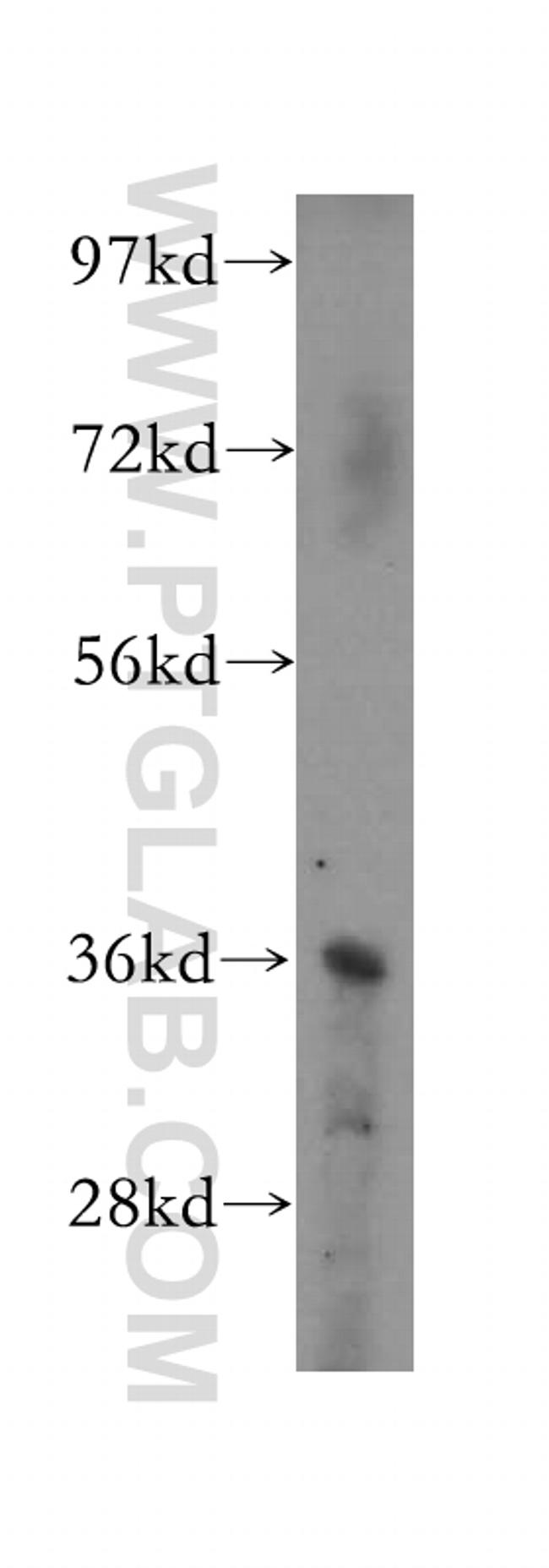 BXDC1 Antibody in Western Blot (WB)