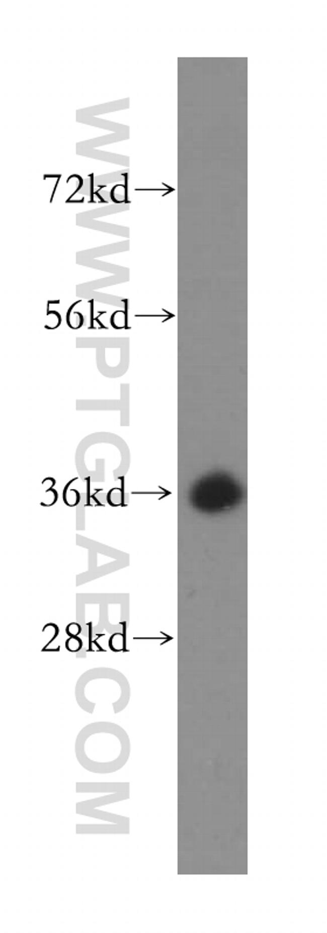 BXDC1 Antibody in Western Blot (WB)