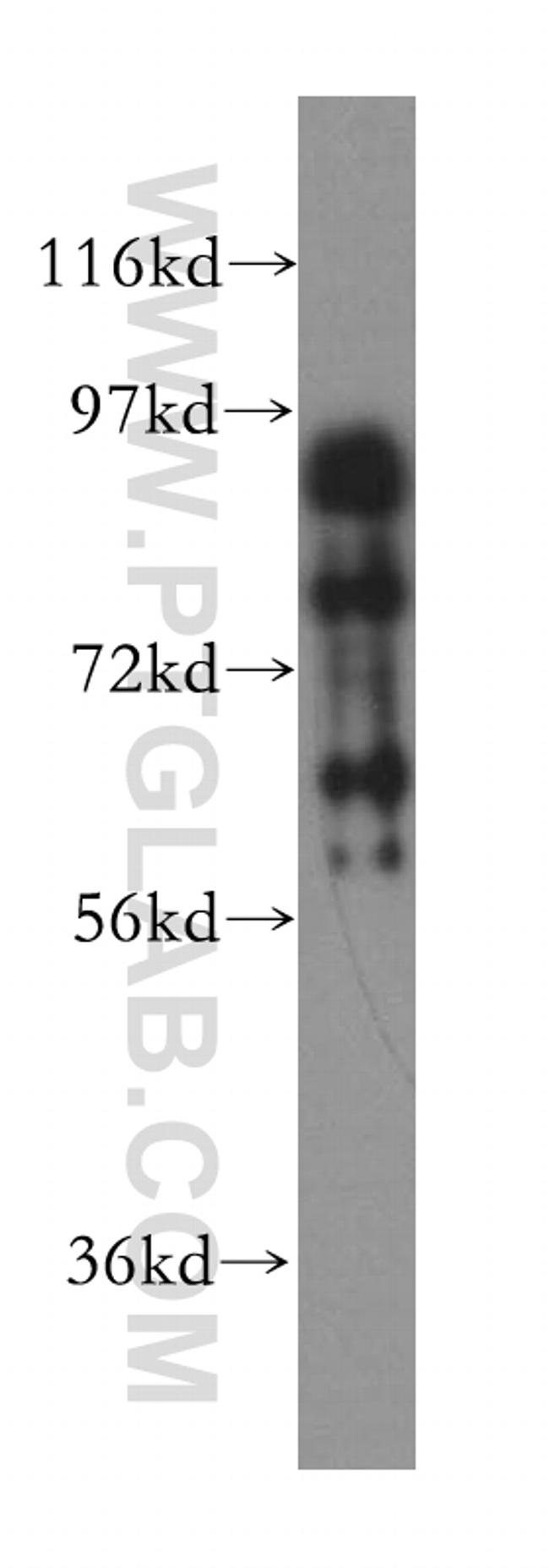 Gamma adducin Antibody in Western Blot (WB)