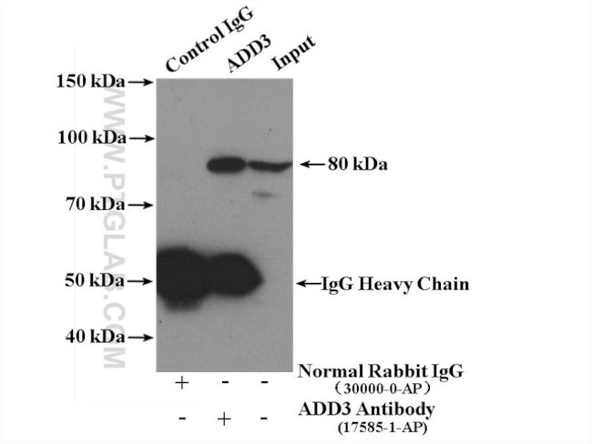 Gamma adducin Antibody in Immunoprecipitation (IP)