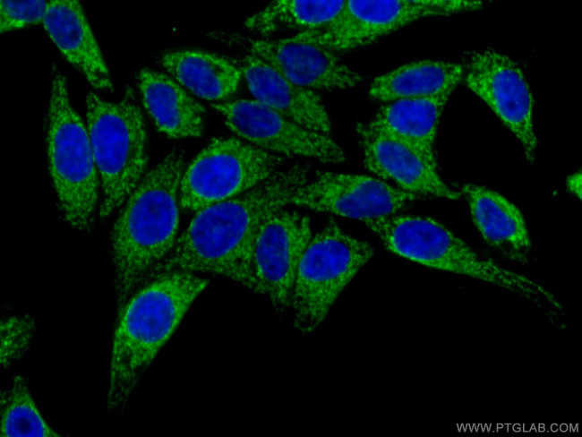 ATP5H Antibody in Immunocytochemistry (ICC/IF)