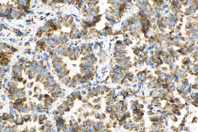 ATP5H Antibody in Immunohistochemistry (Paraffin) (IHC (P))