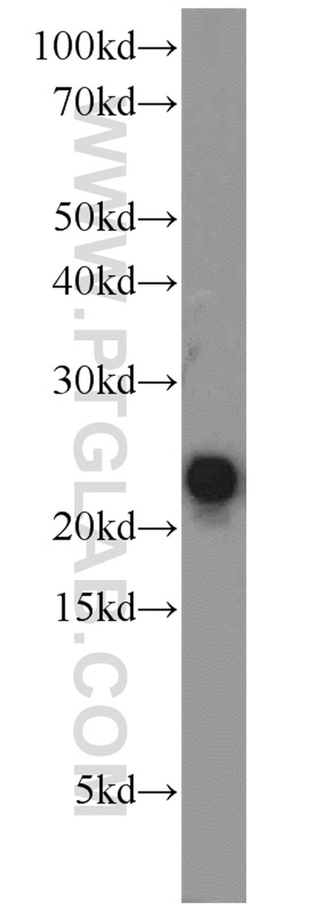 ATP5H Antibody in Western Blot (WB)