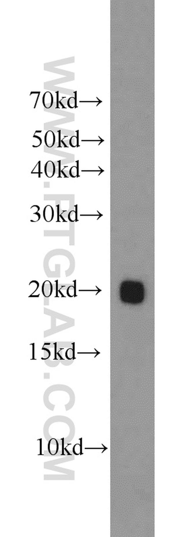 ATP5H Antibody in Western Blot (WB)