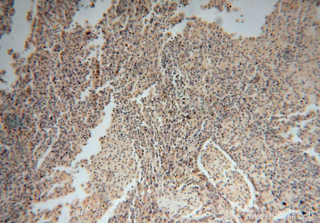 DDX43 Antibody in Immunohistochemistry (Paraffin) (IHC (P))