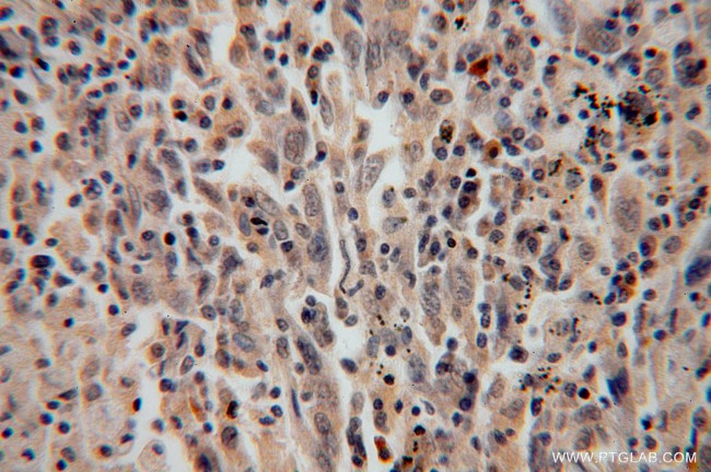 DDX43 Antibody in Immunohistochemistry (Paraffin) (IHC (P))