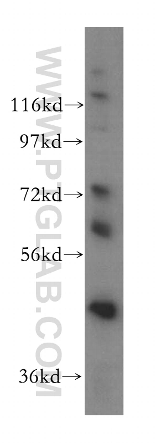 DDX43 Antibody in Western Blot (WB)