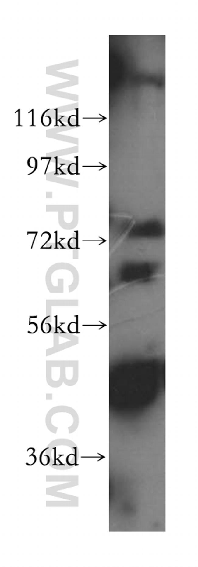 DDX43 Antibody in Western Blot (WB)