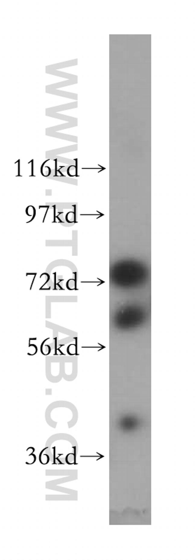 DDX43 Antibody in Western Blot (WB)