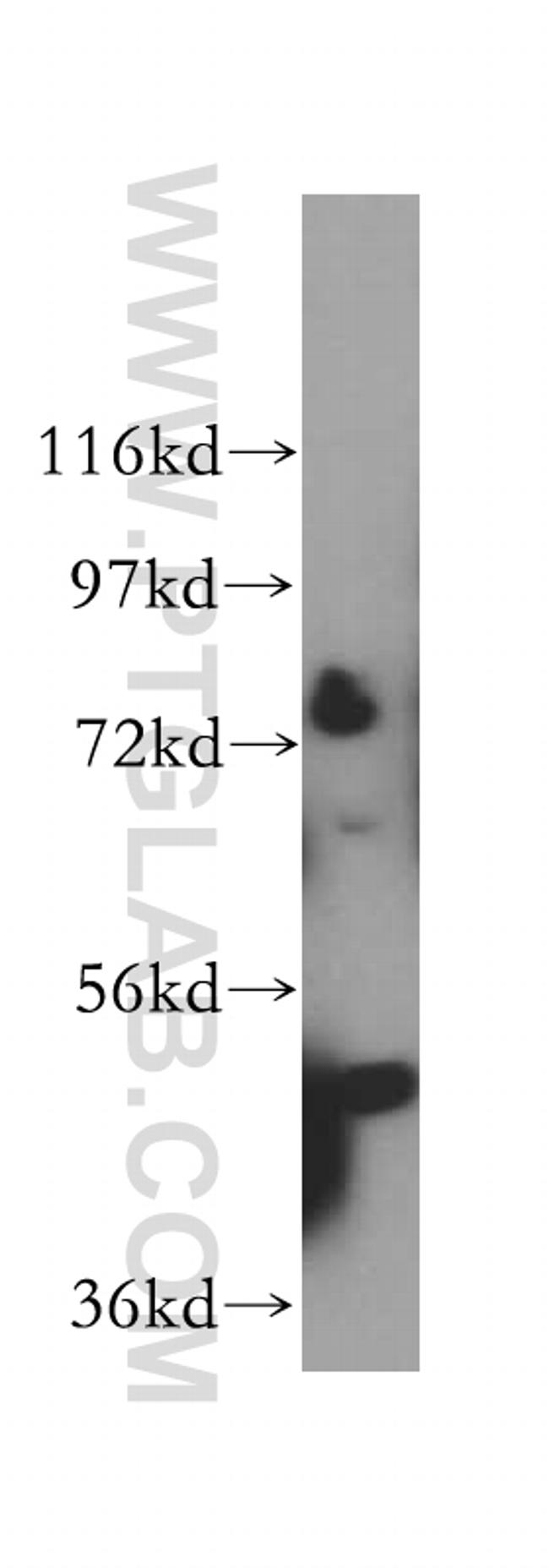 DDX43 Antibody in Western Blot (WB)