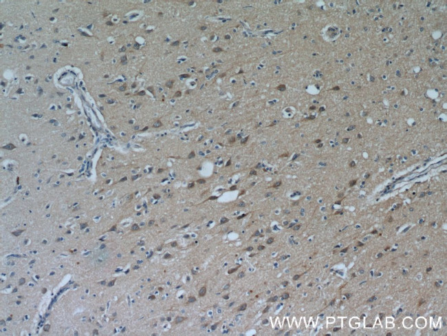 PYK2 Antibody in Immunohistochemistry (Paraffin) (IHC (P))