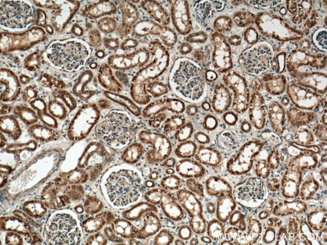 PYK2 Antibody in Immunohistochemistry (Paraffin) (IHC (P))