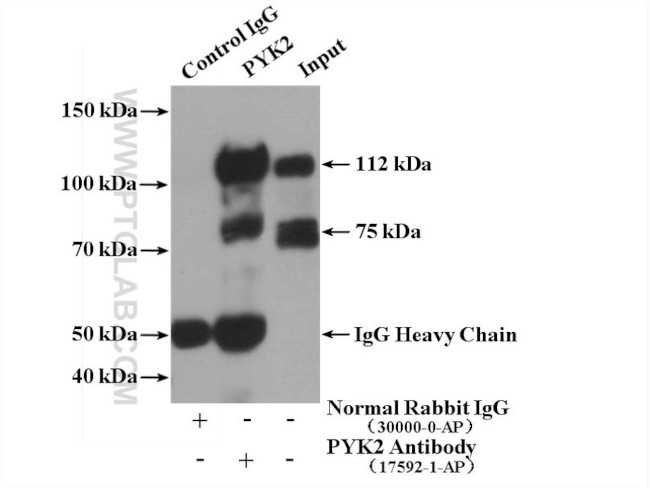 PYK2 Antibody in Immunoprecipitation (IP)