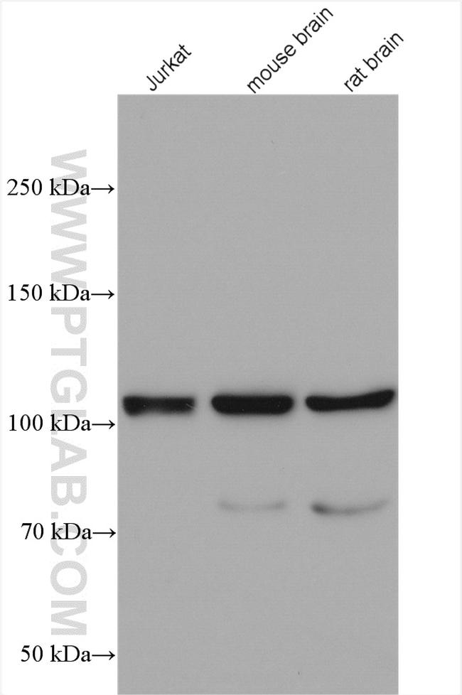 PYK2 Antibody in Western Blot (WB)